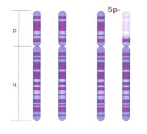 NORD photo of good and bad chromosome.